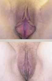 [before/after]